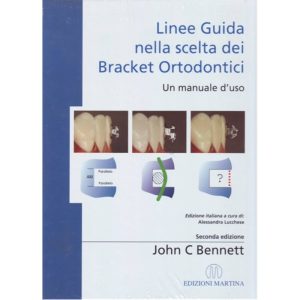 Linee guida nella scelta dei Bracket ortodontici - Un manuale d'uso